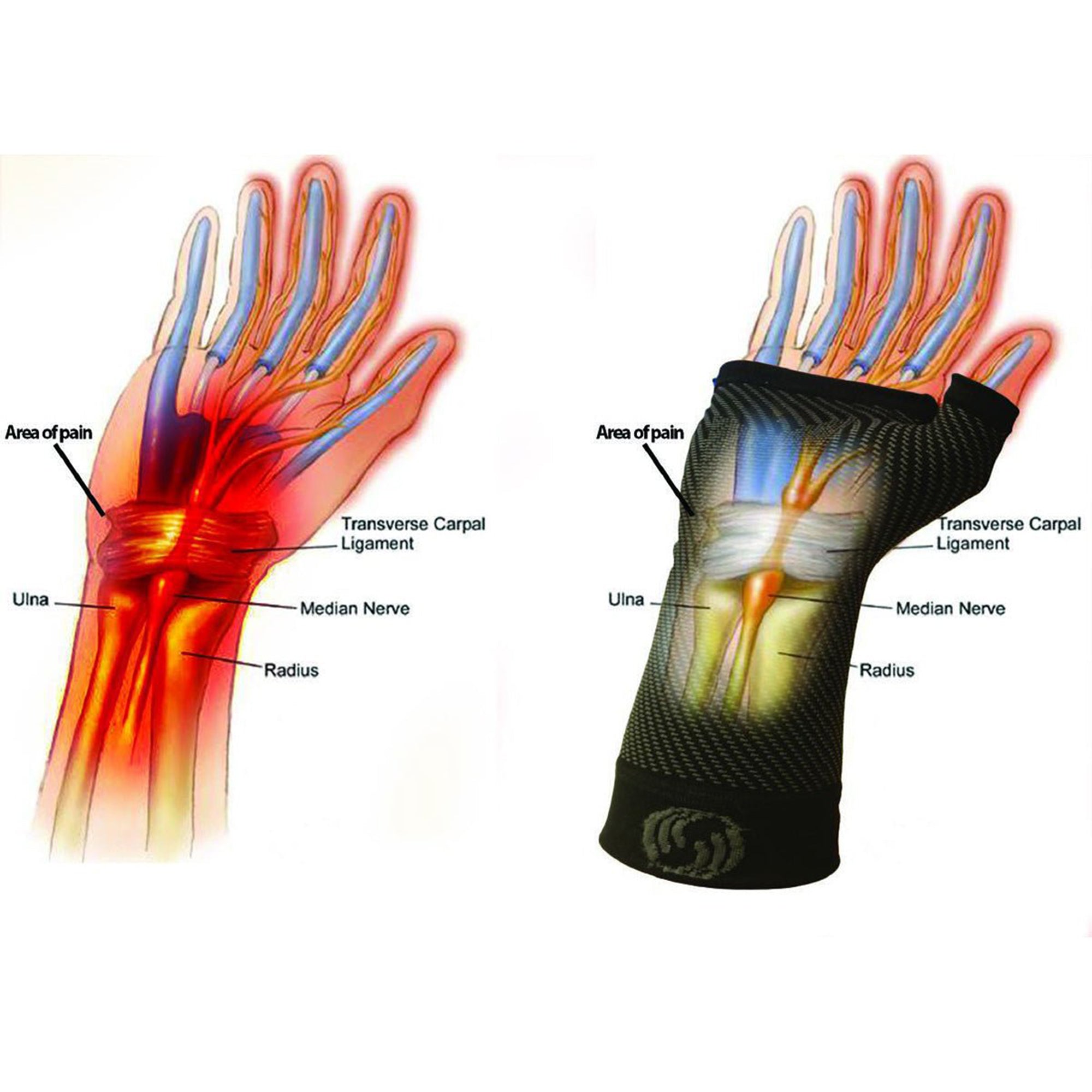 OS1ST OS快速WS6 WS6列表套筒